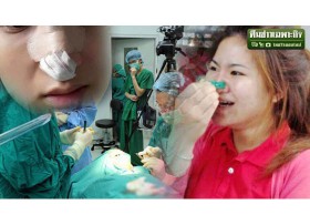 ดั้งโด่งจริงหรือ? เปิดพิษสงร้ายไม้หนีบผ้าดึงจมูก