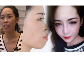 ทำหน้าสวยชาตินี้! ขยี้ตา 2 ทีเพื่อลบภาพเก่า ศัลยกรรมเปลี่ยนชีวิต